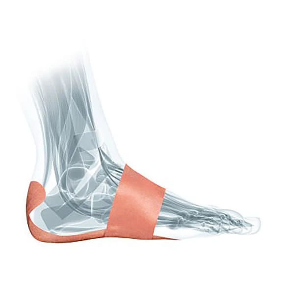 Mueller PFTape Plantar Fasciitis Pain Relief System Beige (7 Pack) - Image 3